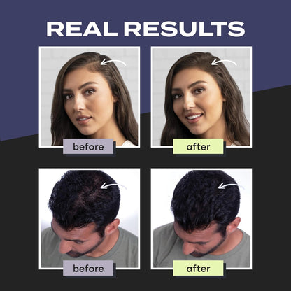 Toppik - Hair Building Fibers - .55g